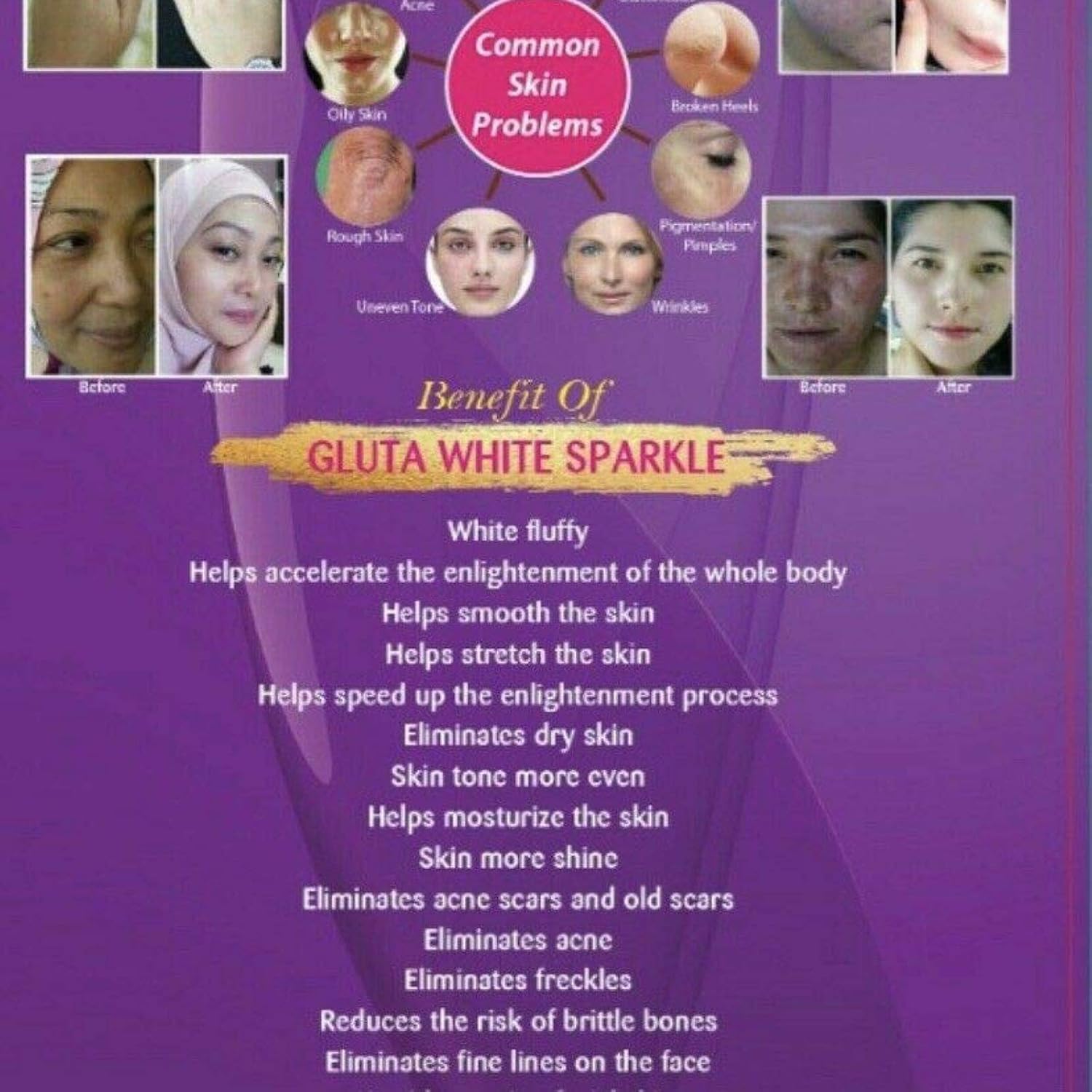 GLUTA White Sparkle L-GLUTATHIONE Plus Best 2X Skin WHITENING Supplement 750G